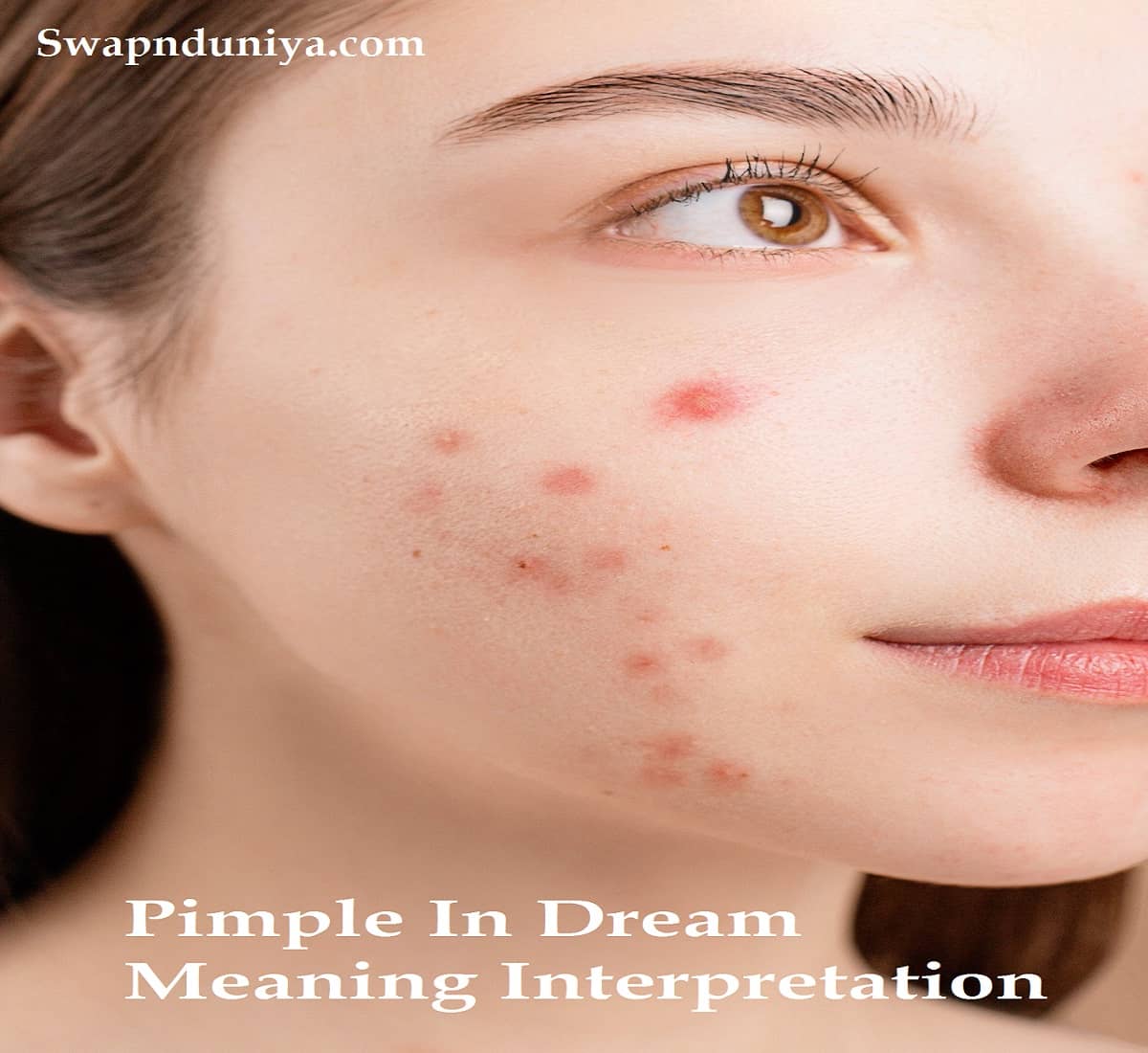 Pimple In Dream Meaning Interpretation